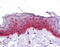 Bone Morphogenetic Protein 7 antibody, ARP32328_P050, Aviva Systems Biology, Immunohistochemistry paraffin image 