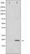 p18 antibody, TA325360, Origene, Western Blot image 