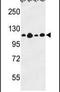 Collagen Type XVII Alpha 1 Chain antibody, PA5-26108, Invitrogen Antibodies, Western Blot image 