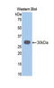 Chymotrypsin-like elastase family member 3B antibody, LS-C299768, Lifespan Biosciences, Western Blot image 