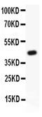 TEK Receptor Tyrosine Kinase antibody, PA5-80103, Invitrogen Antibodies, Western Blot image 