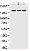 Fms Related Tyrosine Kinase 1 antibody, PA1399, Boster Biological Technology, Western Blot image 