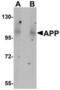 Amyloid Beta Precursor Protein antibody, TA306763, Origene, Western Blot image 
