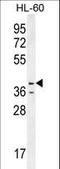 Caspase-12 antibody, LS-C168327, Lifespan Biosciences, Western Blot image 