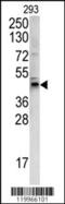 Protein Wnt-4 antibody, 62-400, ProSci, Western Blot image 