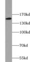 Centromere Protein J antibody, FNab01587, FineTest, Western Blot image 