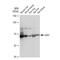 CES2 antibody, GTX03183, GeneTex, Western Blot image 
