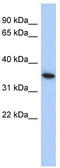 MAX Interactor 1, Dimerization Protein antibody, TA329265, Origene, Western Blot image 