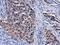 Deoxycytidine Kinase antibody, NBP2-43639, Novus Biologicals, Immunohistochemistry frozen image 