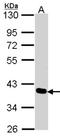 PDZ And LIM Domain 4 antibody, NBP2-19759, Novus Biologicals, Western Blot image 