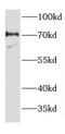 Deformed epidermal autoregulatory factor 1 homolog antibody, FNab02320, FineTest, Western Blot image 