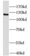 PTK2 antibody, FNab02950, FineTest, Western Blot image 