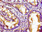 Kinesin Family Member 5B antibody, CSB-PA012342LA01HU, Cusabio, Immunohistochemistry paraffin image 