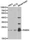 RAB5A, Member RAS Oncogene Family antibody, TA326977, Origene, Western Blot image 