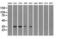 CD32a antibody, LS-C114763, Lifespan Biosciences, Western Blot image 