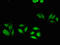 ATP Binding Cassette Subfamily C Member 4 antibody, orb47819, Biorbyt, Immunocytochemistry image 