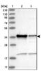 Zinc Finger CCCH-Type Containing 8 antibody, NBP1-84661, Novus Biologicals, Western Blot image 