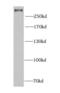 PCM1 antibody, FNab06212, FineTest, Western Blot image 
