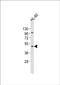 Carbohydrate Sulfotransferase 12 antibody, PA5-49399, Invitrogen Antibodies, Western Blot image 