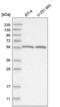 FA Complementation Group C antibody, NBP2-55256, Novus Biologicals, Western Blot image 