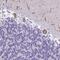 P21 (RAC1) Activated Kinase 3 antibody, NBP2-38890, Novus Biologicals, Immunohistochemistry paraffin image 