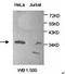 Protein Kinase AMP-Activated Non-Catalytic Subunit Gamma 1 antibody, orb309114, Biorbyt, Western Blot image 