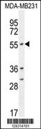 Cytochrome P450 Family 2 Subfamily A Member 7 antibody, 55-205, ProSci, Western Blot image 