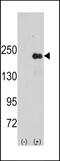 Sperm Associated Antigen 9 antibody, GTX81547, GeneTex, Western Blot image 