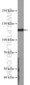 Potassium Voltage-Gated Channel Subfamily B Member 1 antibody, 19963-1-AP, Proteintech Group, Western Blot image 