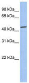 Casein Kinase 2 Alpha 1 antibody, TA340033, Origene, Western Blot image 