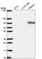 Gelsolin antibody, HPA054026, Atlas Antibodies, Western Blot image 