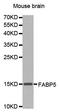 Fatty Acid Binding Protein 5 antibody, orb135490, Biorbyt, Western Blot image 