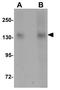 NLR Family CARD Domain Containing 3 antibody, GTX31989, GeneTex, Western Blot image 