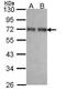 Coiled-coil domain-containing protein 6 antibody, GTX107599, GeneTex, Western Blot image 