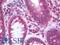 SNK antibody, LS-B9872, Lifespan Biosciences, Immunohistochemistry paraffin image 