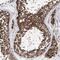 Cilia And Flagella Associated Protein 46 antibody, NBP2-48697, Novus Biologicals, Immunohistochemistry frozen image 