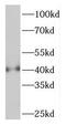 PHD Finger Protein 6 antibody, FNab06388, FineTest, Western Blot image 