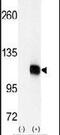 Diacylglycerol Kinase Zeta antibody, PA5-15319, Invitrogen Antibodies, Western Blot image 