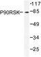 Ribosomal Protein S6 Kinase A1 antibody, AP06435PU-N, Origene, Western Blot image 