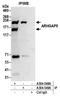 Rho GTPase Activating Protein 5 antibody, A304-548A, Bethyl Labs, Immunoprecipitation image 