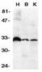 TNF Receptor Superfamily Member 6b antibody, NBP1-76909, Novus Biologicals, Western Blot image 