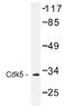 Cyclin Dependent Kinase 5 antibody, AP01458PU-N, Origene, Western Blot image 