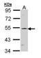 Recombining binding protein suppressor of hairless antibody, orb74053, Biorbyt, Western Blot image 