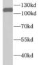 Ubiquitin Like With PHD And Ring Finger Domains 1 antibody, FNab09245, FineTest, Western Blot image 
