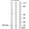 Protein Phosphatase 1 Regulatory Inhibitor Subunit 14C antibody, A10973, Boster Biological Technology, Western Blot image 