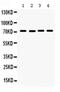 Fragile X Mental Retardation 1 antibody, PA5-79278, Invitrogen Antibodies, Western Blot image 