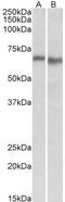Protein Kinase AMP-Activated Catalytic Subunit Alpha 2 antibody, GTX88046, GeneTex, Western Blot image 