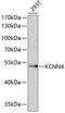 Potassium Calcium-Activated Channel Subfamily N Member 4 antibody, 18-422, ProSci, Western Blot image 