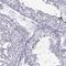Doublesex And Mab-3 Related Transcription Factor 3 antibody, HPA077685, Atlas Antibodies, Immunohistochemistry frozen image 