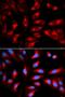 WW Domain Binding Protein 4 antibody, orb325728, Biorbyt, Immunocytochemistry image 